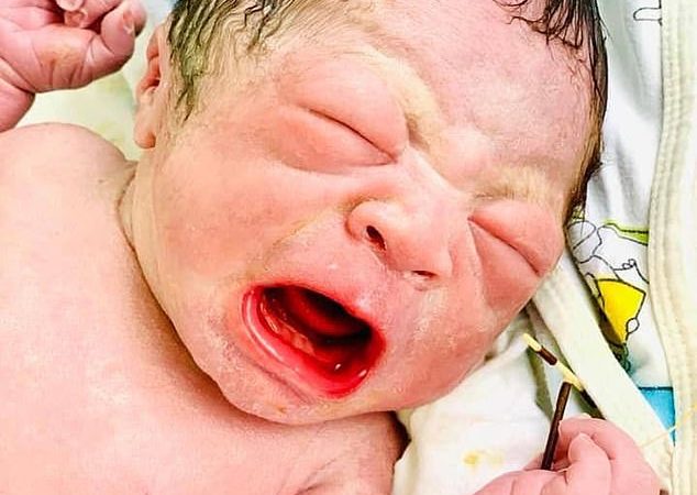 Incredibil ce are bebelușul în mână în momentul nașterii! Fotografiile au devenit virale.
