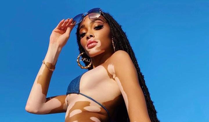 Winnie Harlow la celebrarea a 26 de ani, mai sexy ca niciodată. La plajă în Mexic