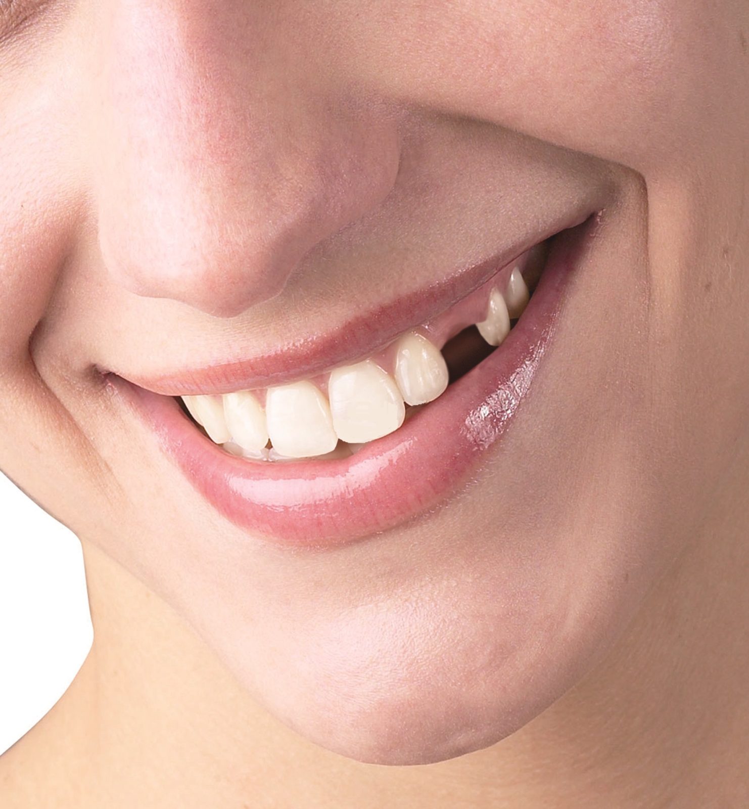 Reguli de aur pentru dinți sănătoși. Cum să avem un zâmbet perfect