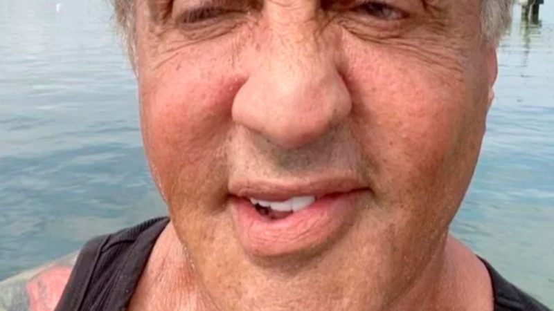 La 75 de ani, Sylvester Stallone e desfigurat din cauza operațiilor estetice