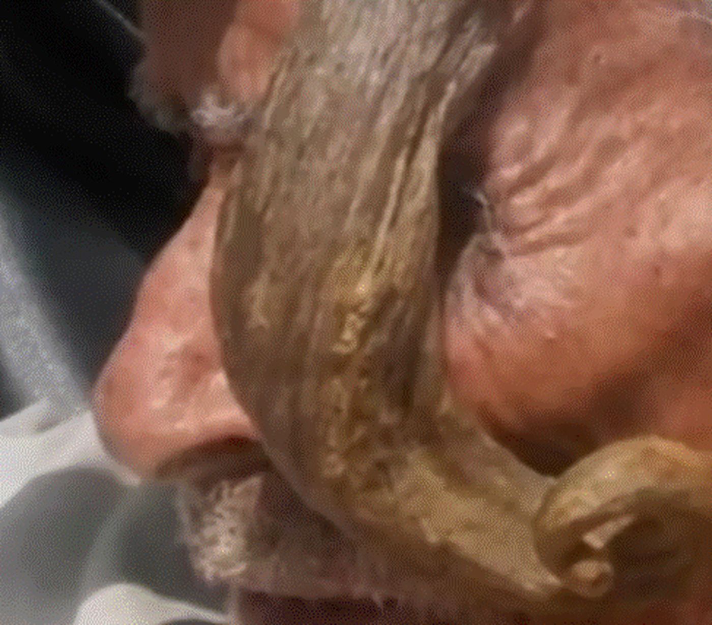 A murit bărbatul cu coarne, cel mai bătrân din lume. Se spune că avea vârsta de 140 de ani