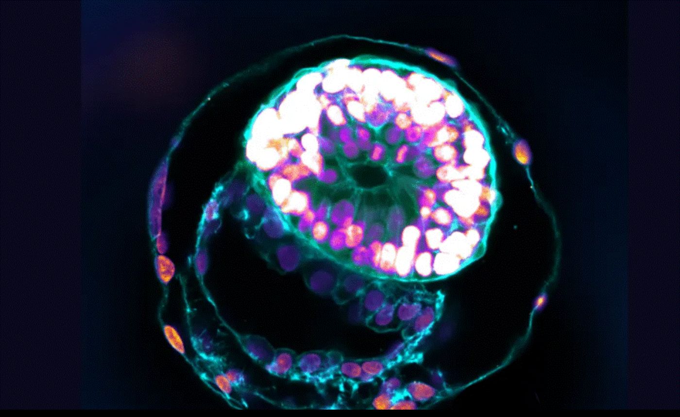 Revoluție medicală: Embrioni umani creați în laborator. Nu este nevoie de mame sau tați