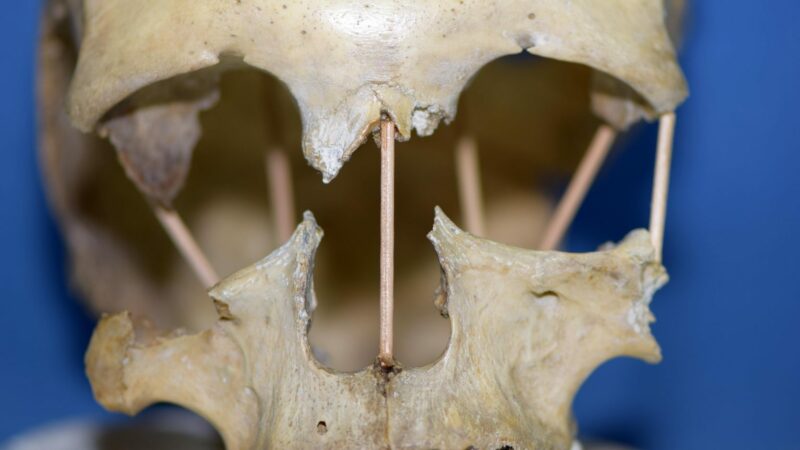 Craniul de femeie găsit în Peștera Muierii. Au aflat al cui este, iar analizele arată foarte ciudat