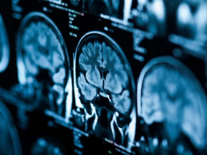 Studiu șocant! Adolescența creierului durează până la 32 de ani