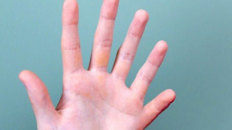 În viitor, oamenii pot avea șase degete la o mână. Specialiștii spun ce beneficii ar putea aduce unui individ