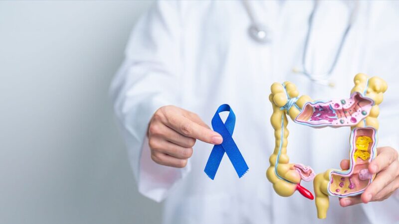 O băutură consumată zilnic reduce considerabil riscul de cancer de colon. Descoperire uluitoare