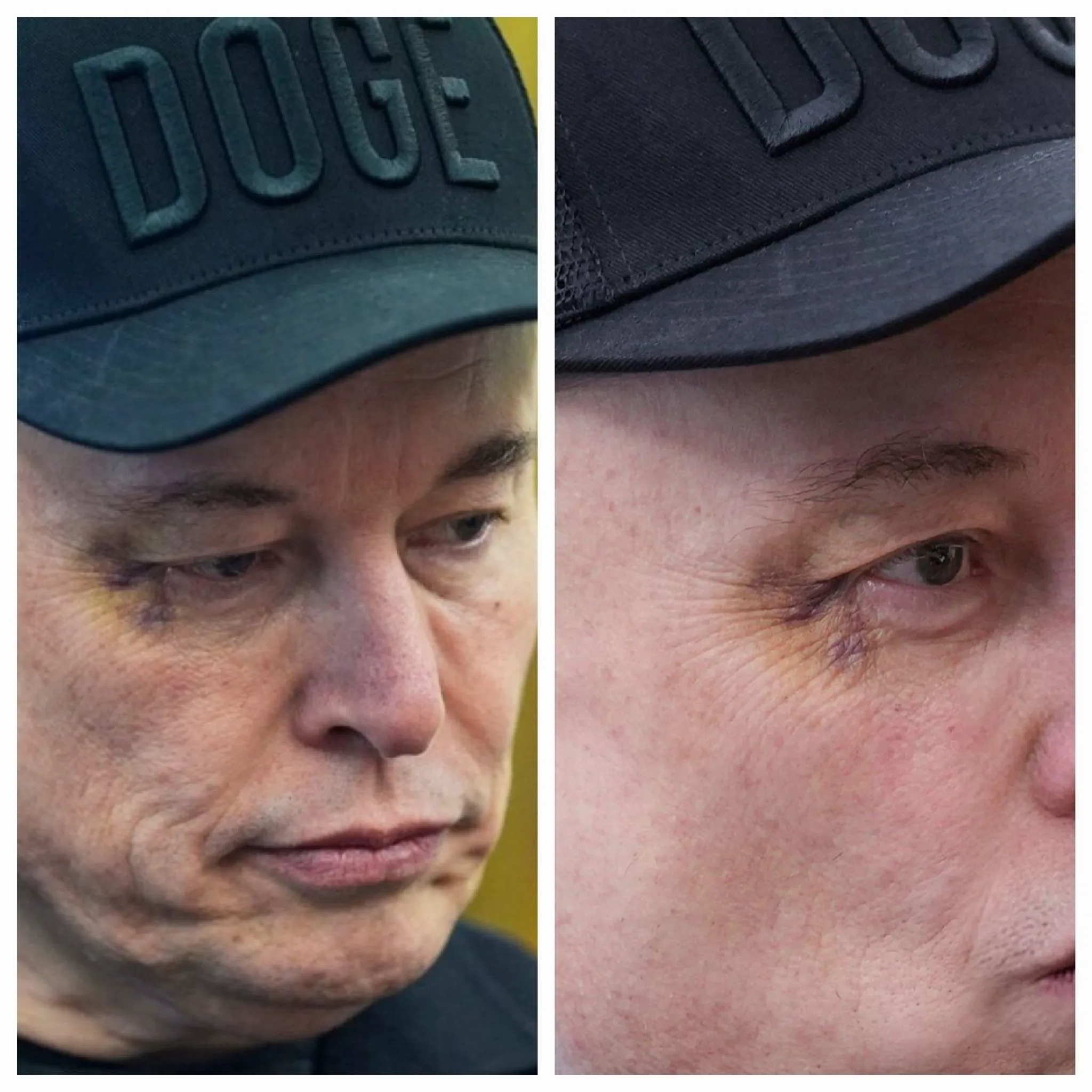 Donald Trump îi dă sfaturi în căsnicie lui Maron, după lovitura aplicată de soție. Elon Musk, cu ochiul vânăt, intervine și el 