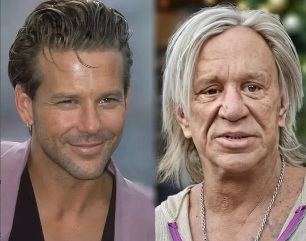 În ce hal a ajuns actorul Mickey Rourke la 72 de ani. Imagini dezolante