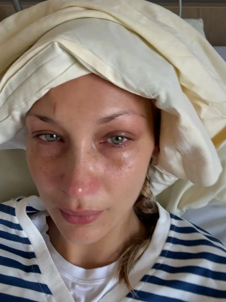 Boala provocată de căpușe a revenit, iar vedeta a ajuns la spital. Cât de gravă este starea ei