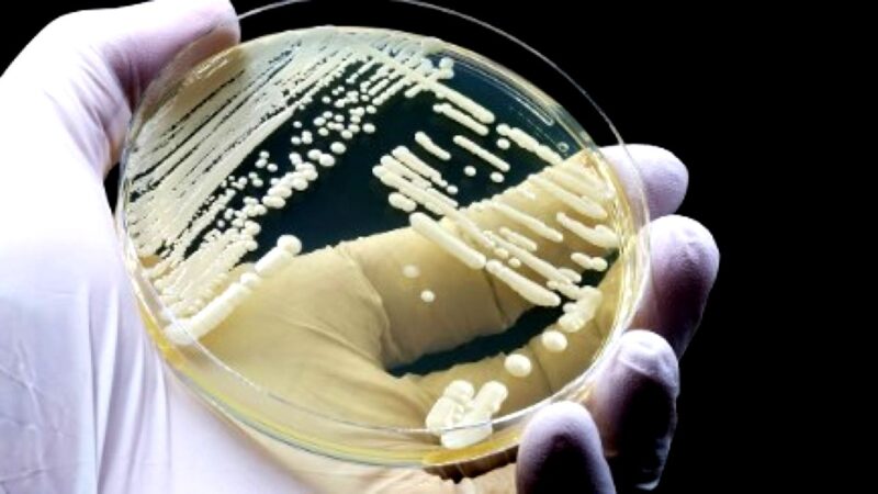Ciuperca Candida auris, o amenințare invizibilă, dar letală. Centrul European pentru Prevenirea și Controlul Bolilor cere măsuri urgente. Cum să vă protejați