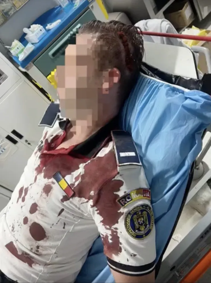 Uniforma unui polițist, plină de sânge, plimbată printre cetățeni. Agentul a fost bătut cu bestialitate – Foto