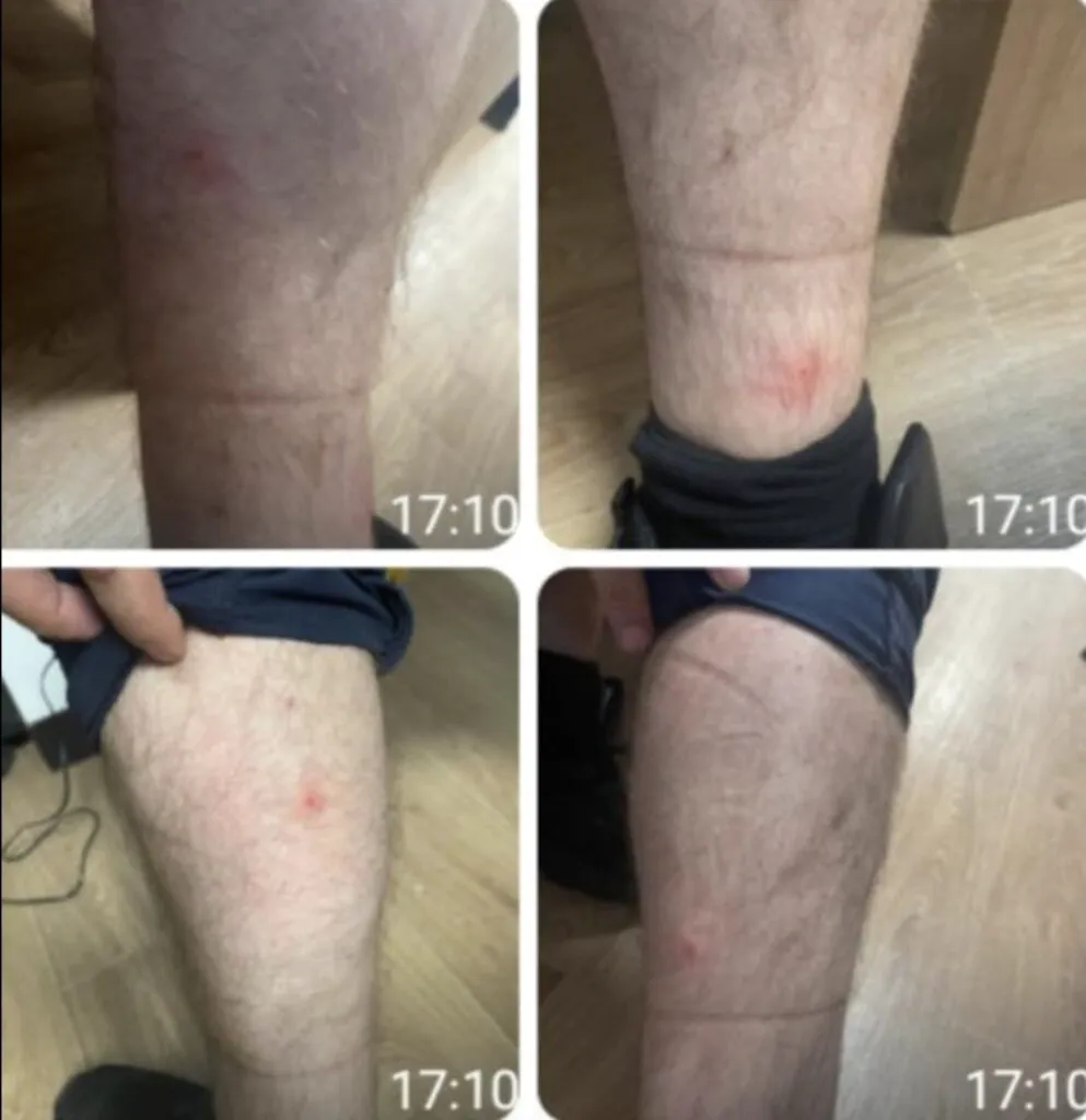 Uniforma unui polițist, plină de sânge, plimbată printre cetățeni. Agentul a fost bătut cu bestialitate – Foto