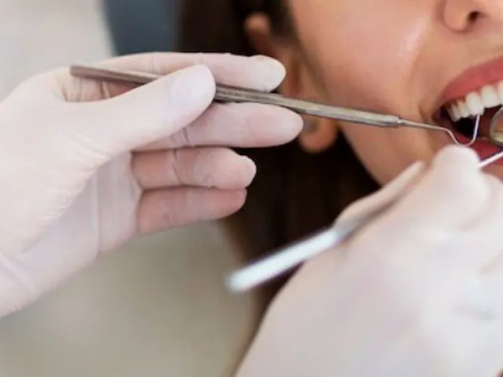 Fructul care previne apariția bolilor gingivale. Ce au descoperit oamenii de știință