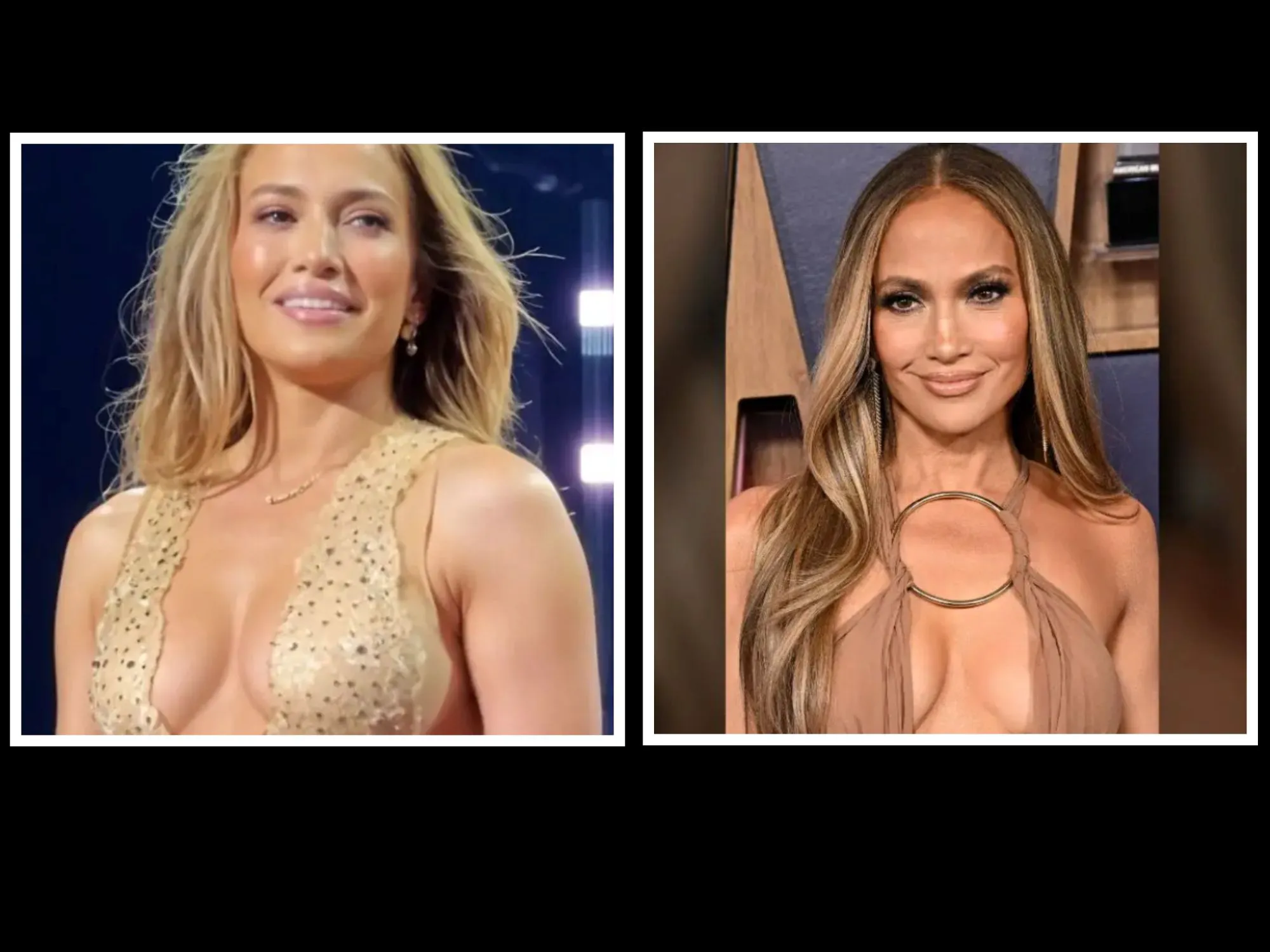Jennifer Lopez a început „misiunea de autoîmbunătățire”. Ce operații estetice și-a făcut vedeta după despărțirea de Ben Affleck