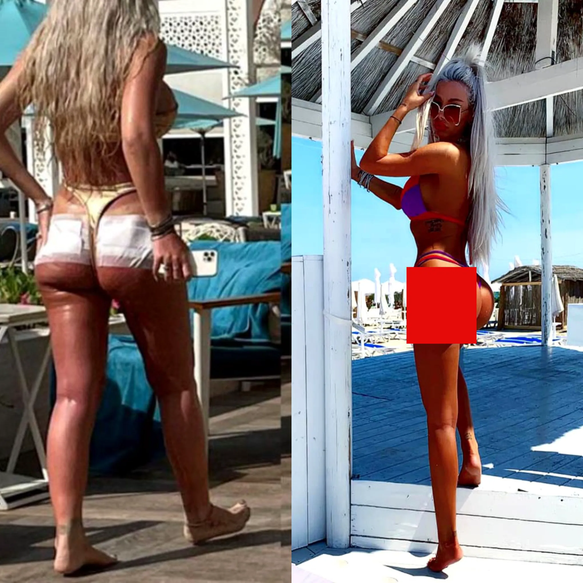 Antonia, după infectarea intervenției la fese spune adevărul: „Am început să mă îngraș”