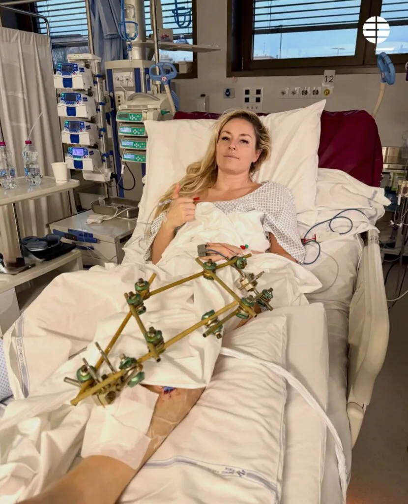 Accidentul de la Jocurile Olimpice 2026 care a îngrozit lumea: „Piciorul trebuia amputat” – Video 4 Accidentul de la Jocurile Olimpice 2026 care a îngrozit lumea: „Piciorul trebuia amputat” – Video