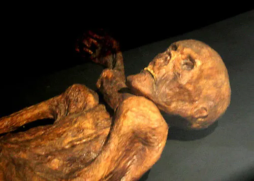 Rămășițele mumificate ale lui Ötzi, expuse la Muzeul de Arheologie din Tirolul de Sud, unde au fost descoperite urme ale bacteriei asociate cu boala Lyme (foto: Wikipedia)