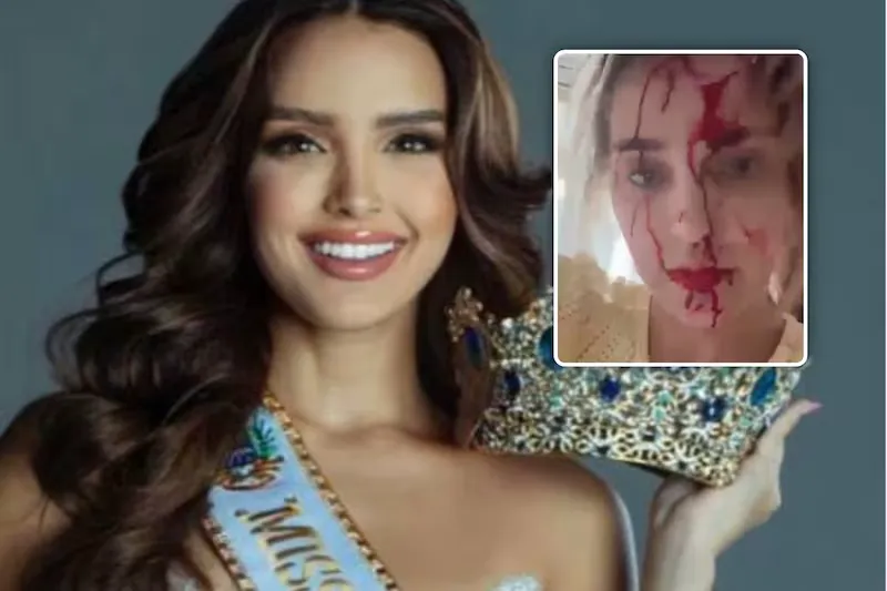 Miss Venezuela, plină de sânge după un scandal izbucnit la Cannes 2026. Stilistul a fost arestat