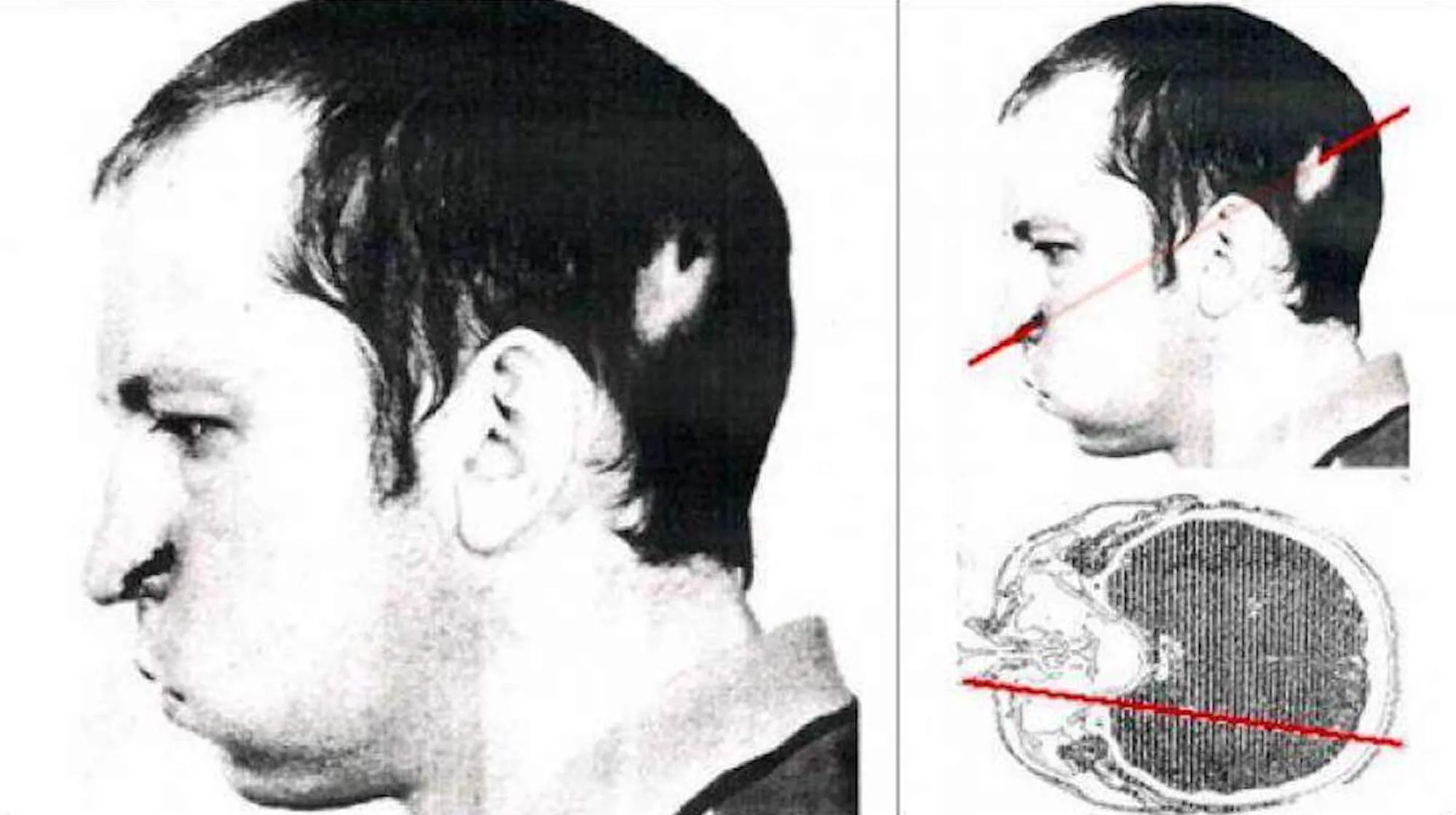 Lovitura fizicianului Anatoli Bugorski