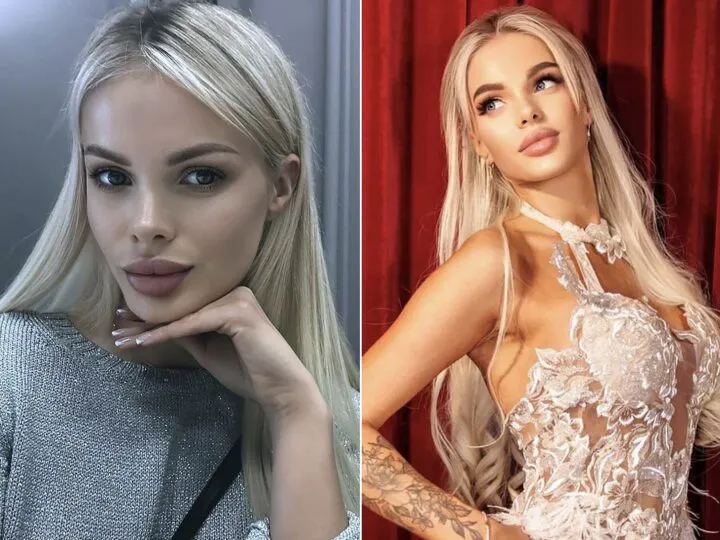 Caz șocant, similar cu cel al Danei Roba. Fotomodel rus, bătut cu bestialitate de iubitul milionar