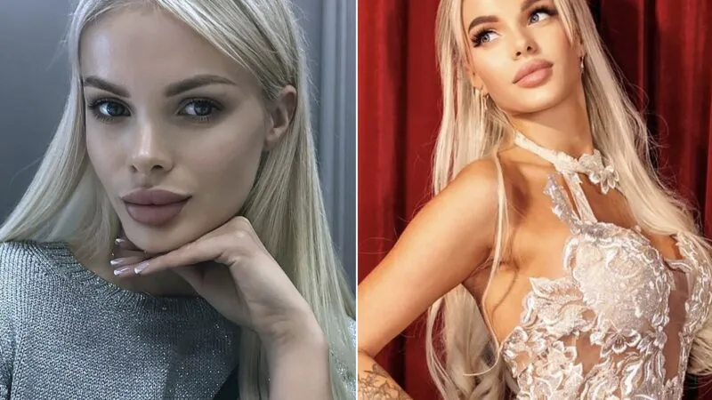 Caz șocant, similar cu cel al Danei Roba. Fotomodel rus, bătut cu bestialitate de iubitul milionar