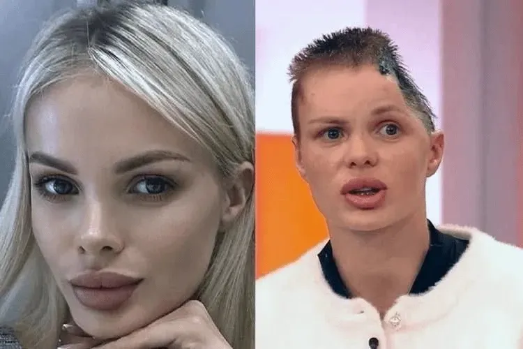 Caz șocant, similar cu cel al Danei Roba. Fotomodel rus, bătut cu bestialitate de iubitul milionar