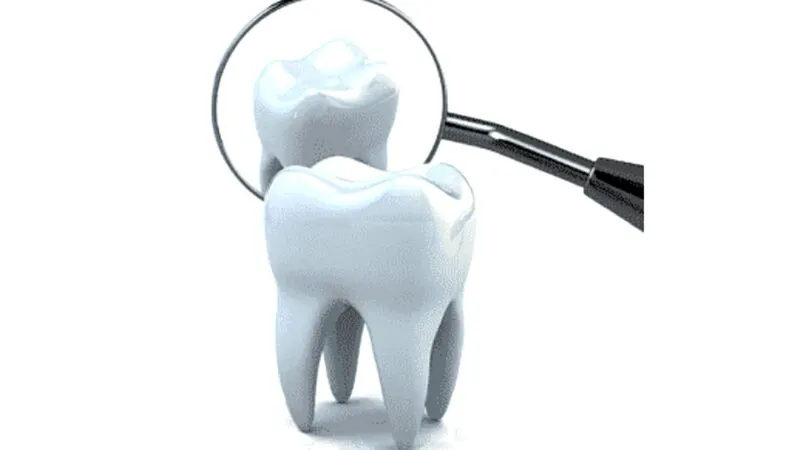 Bancuri. Dentistul… Dați-mi voie să termin lucrarea și o să fiți altă persoană. Ce răspunde pacientul
