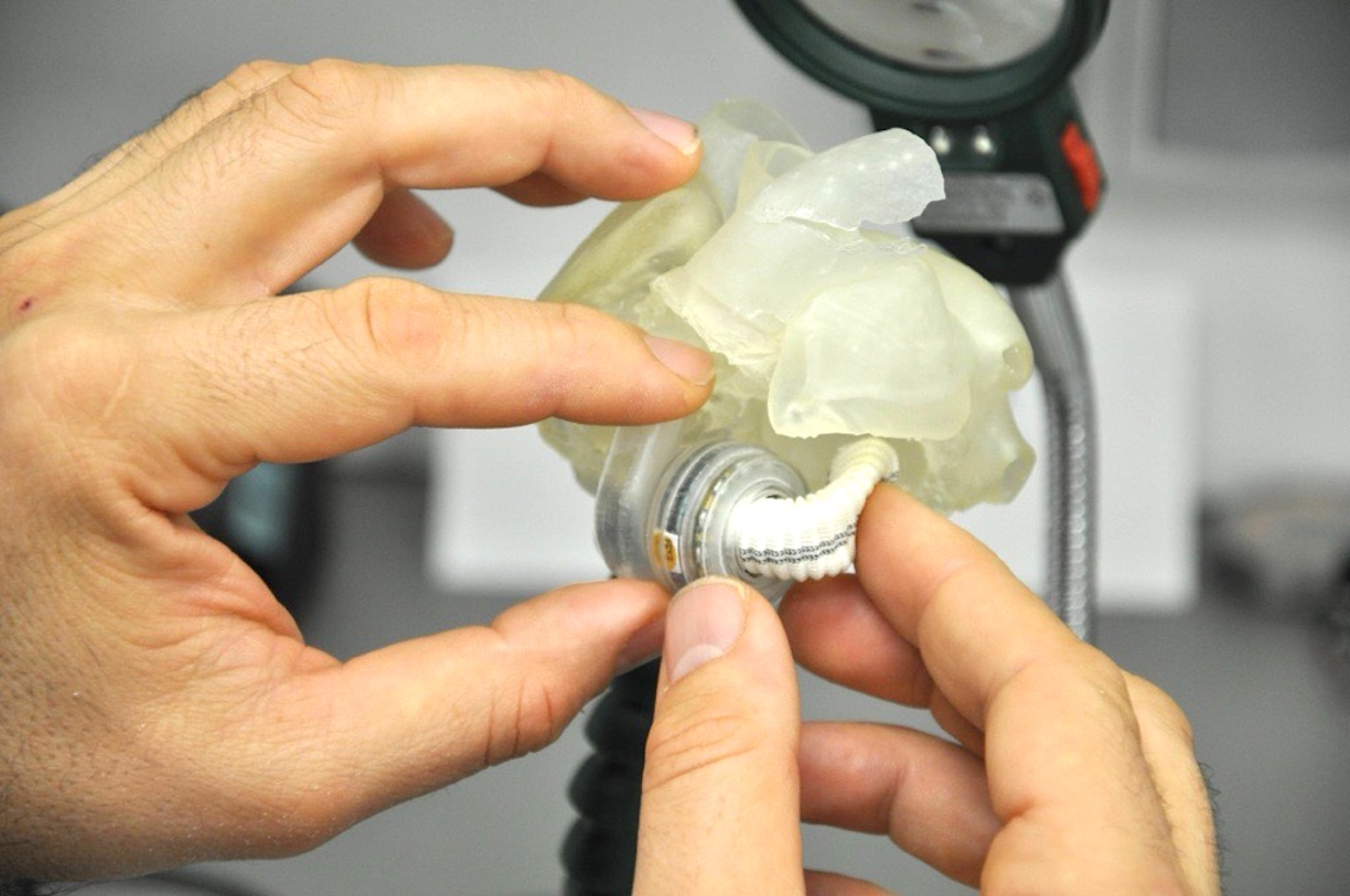 Iașul, pe harta mondială a inovației medicale: echipa MAVIS dezvoltă cea mai mică inimă artificială din lume, destinată copiilor